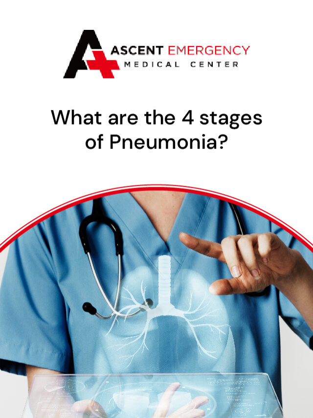 what are the 4 stages of pneumonia?