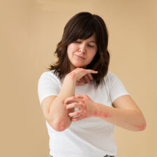 Eczema Symptoms and Causes: When It’s Time for Emergency Care