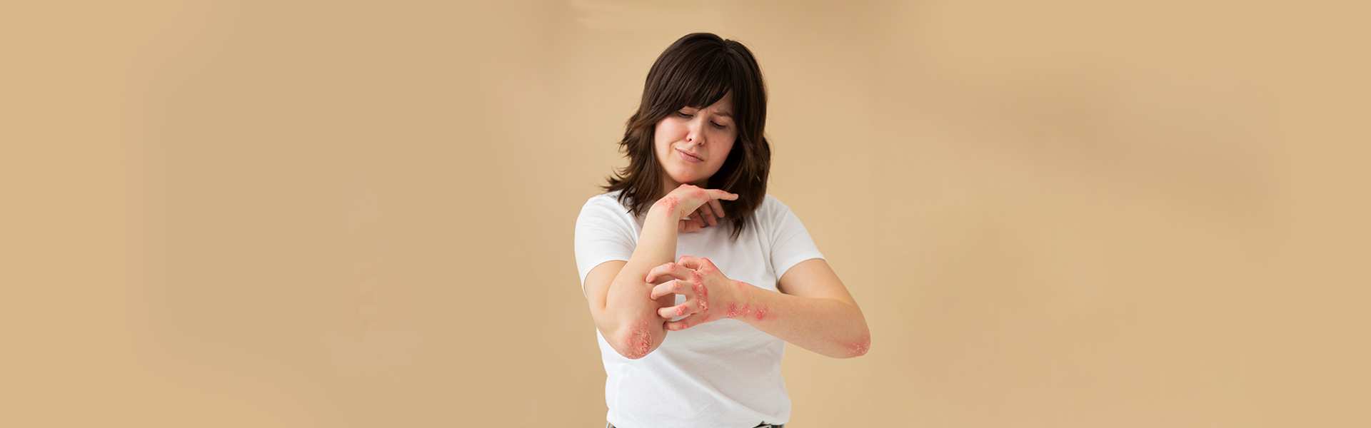 Eczema Symptoms and Causes: When It's Time for Emergency Care